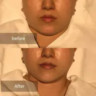 💆♀️フェイシャル💆♀️リフトアップ・小顔💎/4Step工程