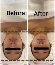 小顔コルギ+初回のみパックor毛穴洗浄付き60分(デコルテ+顔+頭)辛い首肩こりや結果重視の方必見!小顔集中コース!