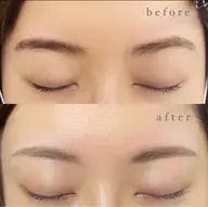 \美眉ワックス脱毛&間引きセット/ before  afterの写真撮影とSNS掲載可能な方限定⚠️注意事項必読⚠️