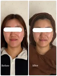 【時短】美白小顔ケア30分 ★毛穴、小顔ケア