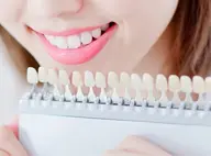 【平日限定16時迄】セルフホワイトニングで白い歯(9分2セット)1回別料金なし