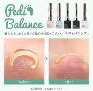 巻き爪ケア含めた1カラー👣【PediBalance】