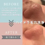 "美容液でお肌を洗う"🫧ハイドラ毛穴洗浄🫧【ピーリング＋毛穴洗浄＋お仕上げパックセット】