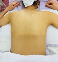 1日ブライダルコース💒一度でこんなに白く😍お顔つやつや✨＆背中美人に！背中の開いたドレスも👗堂々と着られます❣️