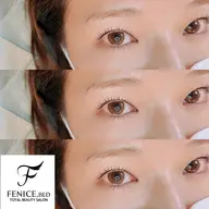 ラッシュリフト上下セット