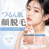 ✨つるん肌顔脱毛+エステ✨憧れのノーファンデ肌へ♪安心シェービング付き🍒U24限定