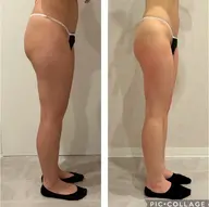 痩身✖️デトックス／60分