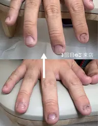 綺麗な縦長爪に✨自爪育成コース3回分🉐お渡し用オイル付き！深爪、噛み癖、貝爪の方もご相談🉑！
