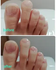 爪ケア30分