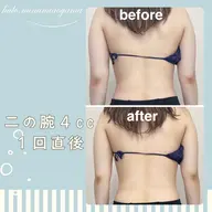 【ミニモ限定】二の腕ハミ肉集中お試し６０分