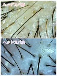 カット+コタ炭酸ヘッドスパ