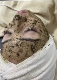 【人気NO④】これで変わらない人見た事ない✨剥離しないハーブピーリングREVI陶肌トリートメント×毛穴エクストラクション