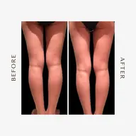 新規限定♥【下半身を何とかしたい！】足痩せコース
