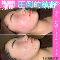 選べるクリスティーナ✨5種類ある中からお肌状況を確認し、一緒に決めていきます😌3回ケアするだけでお肌状況変わります