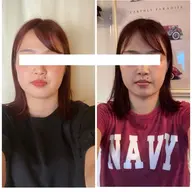 3回の継続が小顔定着への近道！2回目・3回目のお客さま限定プラン