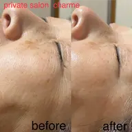 再生美容、ダレノガレ明美さん、田中みな実さん愛用、ハーブマスク体験メニュー！クリスティーナ化粧品ホームケア用マスクお試し