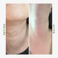 ［オプション］デコルテ