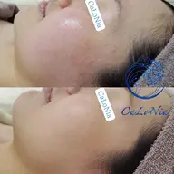 💎肌荒れのお悩みに💎史上最高のつや肌を目指す本格肌質改善💗