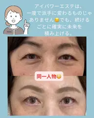 アイパワーエステ