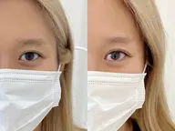 【ご新規様】形状記憶デザインキープラッシュ(LED)160本オフ込み