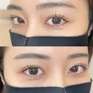 上下ラッシュリフト🌙[TR付]