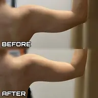 【✨脂肪・たるみ・セルライトまとめてケア】NANIOAFU ボディシェイプ｜1台3役×高コスパ施術〈都度払いOK〉