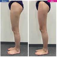 【初回】｟足痩せ｠脱セルライト❗️スラっと美脚💃下半身ダイエットコース【お尻・太もも・ふくらはぎ】