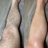 男性限定🉐足ワックス脱毛＋光💡脱毛