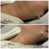 【驚きの2,000円✨】水光肌スキンケア体験💎韓国発インセルダムで内側から発光！悩んでる方にこそ一度試してほしいケア◎