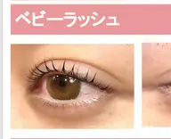 ベビーラッシュ