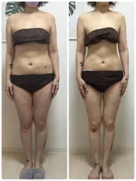 【人気No.1】セル脂肪ケア➕リンパドレナージュ全身