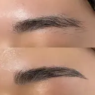 ハリウッドブロウリフト