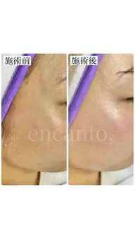 メイクノリ・スキンケアの浸透◎フェイシャルワックス🫧