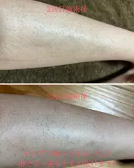 ◆メンズ脚まるごとチクチクしないサラッと肌に