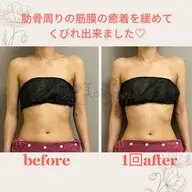 上半身集中の姿勢矯正✨見た目のシルエットも変わる✨お勧め筋膜リリース❣️疲れもスッキリ✨