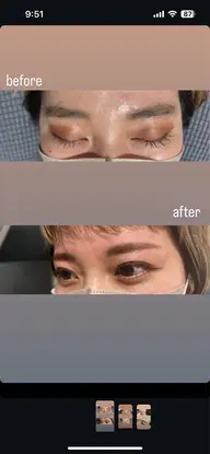 🧡🧡🧡メンズ、レディース問わず眉毛ワックス脱毛🤍🤍🤍