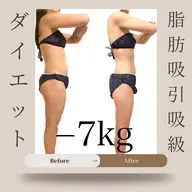 気になる所は全部です！と言うあなた😳【本気全身痩せ】90分¥11000