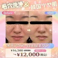 【毛穴・くすみ改善】水光アクア＋白玉酸素★韓国ツヤ肌管理 通常¥16,500→¥12,000