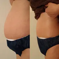 キャビテーション+全身リンパトリートメント70分×8回