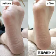 足裏角質ケア👣ガサガサかかと、気になるところバイバイ🙋ふわふわなお足元に🦶✨