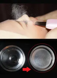 【ご新規様】毛穴ケアコース 65分 11,000円→3,300円