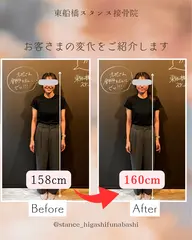 【初回限定】姿勢と小顔のコース|ブライダル特化の接骨院だからこそ出来る究極のご褒美整体。-5歳肌、目線が変わる体験コース