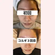 たるみスッキリ✨小顔コルギ×極楽ヘッドスパ付き