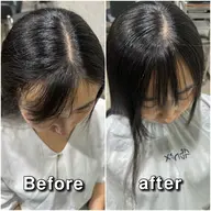 【顔出し撮影可能な方限定】前髪矯正