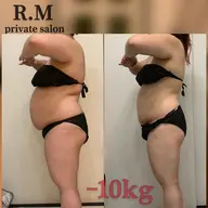 【女性様専用】90分！キャビテーションとバキュームで全身セルライトケア❣️