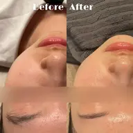 【先着10名🧖🏻‍♀️】ふわもち肌に♡毛穴すっきり洗浄体験🫧