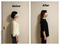 【挙式・前撮り】一生に一度の写真を無加工で。小顔×姿勢改善4回コース ¥35,000