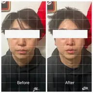 【スッキリ小顔！】メンズ小顔矯正＋ドライヘッドスパ