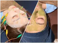 【🪡パック美容鍼×ハーブピーリング🌿】