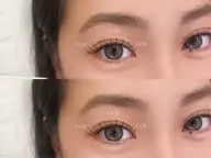 バインドロック:80束⋆˙⟡